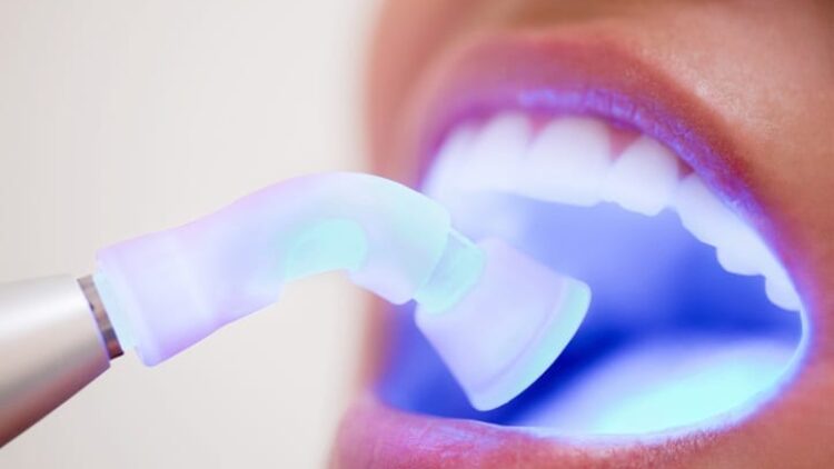 Why Laser Dentistry Can Benefit Patients
