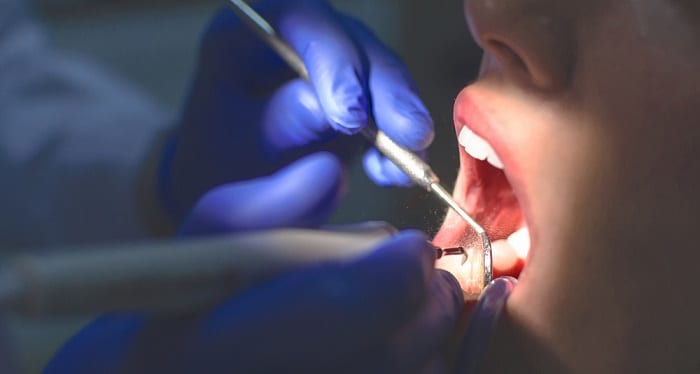 teeth cleaning by dentist
