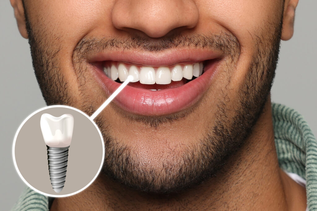 dental implant innovation