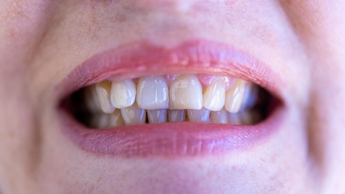 teeth